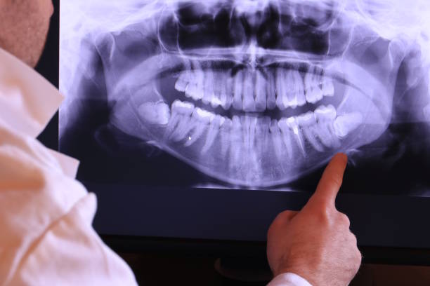 Best Emergency Treatment for Dental Infections or Abscesses in Alpine, TX